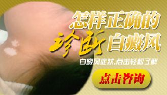如何诊断白癜风白斑比较靠谱