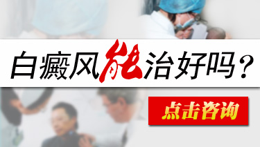 怎么治疗白癜风有效